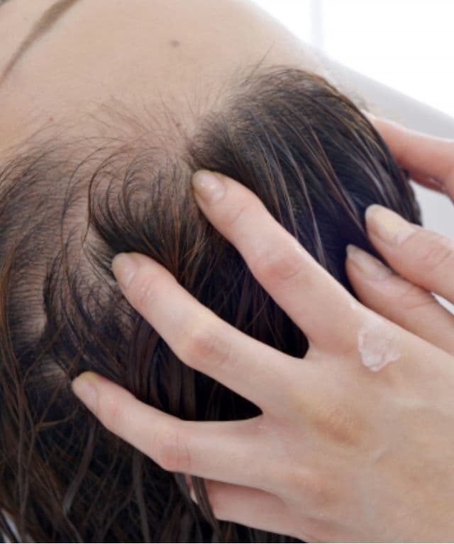 治療中の髪のこと